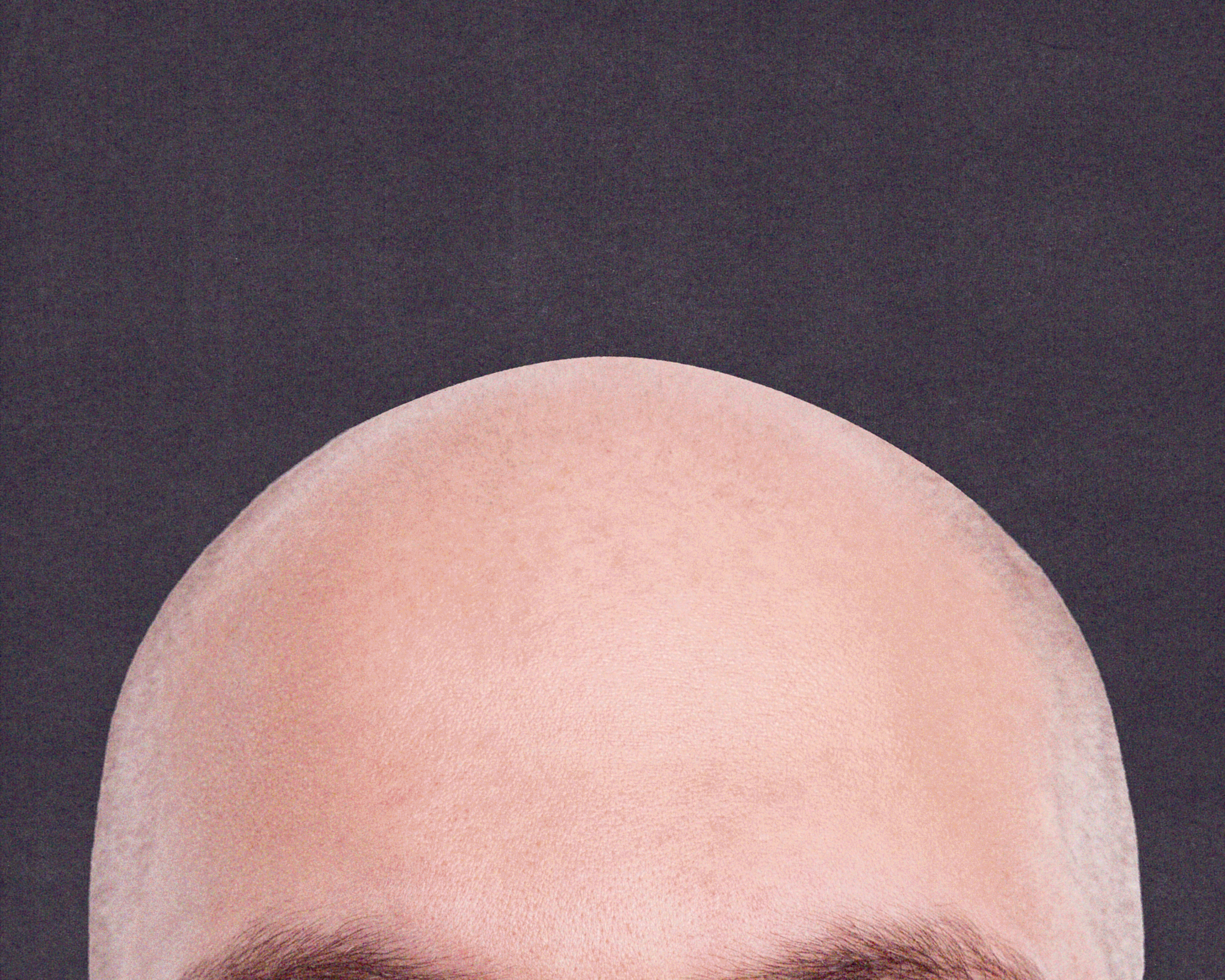 Close-up of a bald head with different emojis appearing gradually